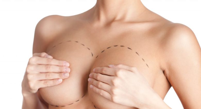 Увеличение груди и подтяжка