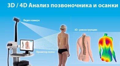 Лечение в Германии суставов и позвоночника, 4D диагностика