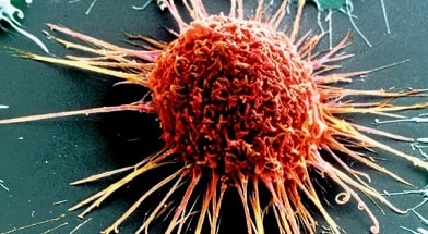 Раковые клетки используют витамин С в качестве щита